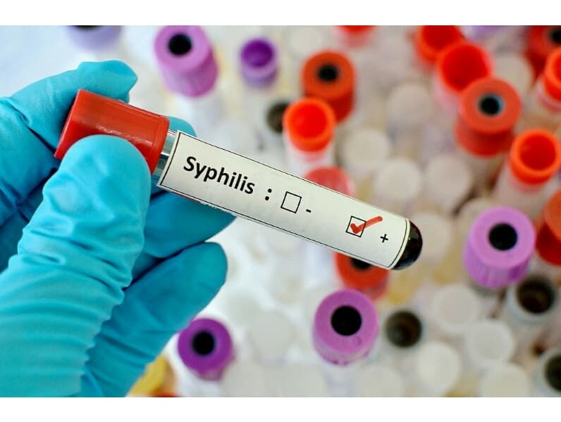 Медики предупреждают об "астрономическом" скачке заражений сифилисом.