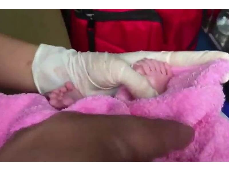 В Чонбури родилась девочка с 12-ю пальцами на руках и ногах.